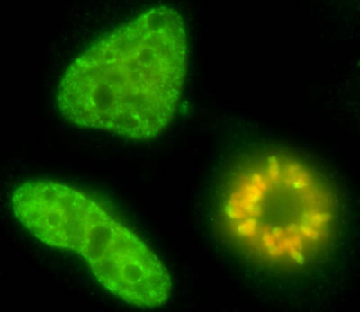 ab9053-Anti-Histone H4 （tri methyl K20） antibody - ChIP Grade （ab9053）-抗体/抗原