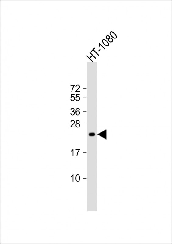 Mouse anti-TIMP2 Monoclonal Antibody(1554CT494.262.47)