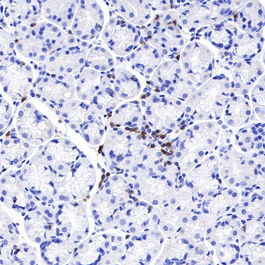 Rabbit anti-CD3 epsilon Recombinant Monoclonal Antibody(241-49)