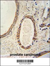 Rabbit anti-TMEM214 Polyclonal Antibody(N-term)