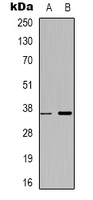 Rabbit anti-ZNF265 Polyclonal Antibody