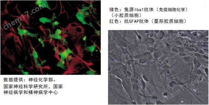 兔源Iba1抗体，无标签疾病研究-wako富士胶片和光