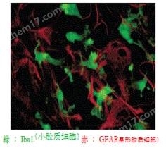 小胶质细胞/巨噬细胞特异性蛋白抗体疾病研究-Wako富士胶片和光