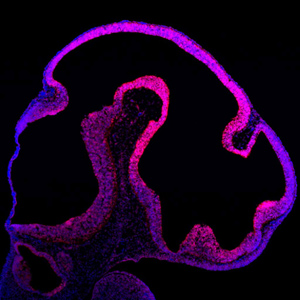 抗体Neural Progenitor Cell Antibodies