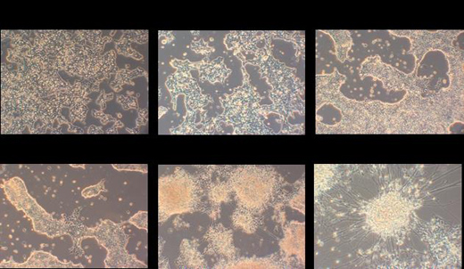 小鼠ES干细胞向神经细胞分化诱导培养基Mouse Neural Differentiation Media (Ndiff 227)