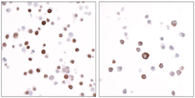 EpiCypher新品推荐——DYKDDDDK Tag CUTANA™ CUT&RUN Antibody