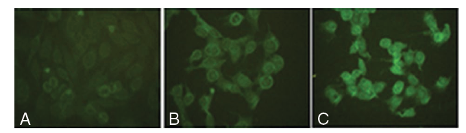 Cayman检测试剂盒(Assay kits)---氧化损伤篇