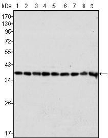 Fitzgerald热销产品10R-C141a，名称Complement C3a alpha antibody