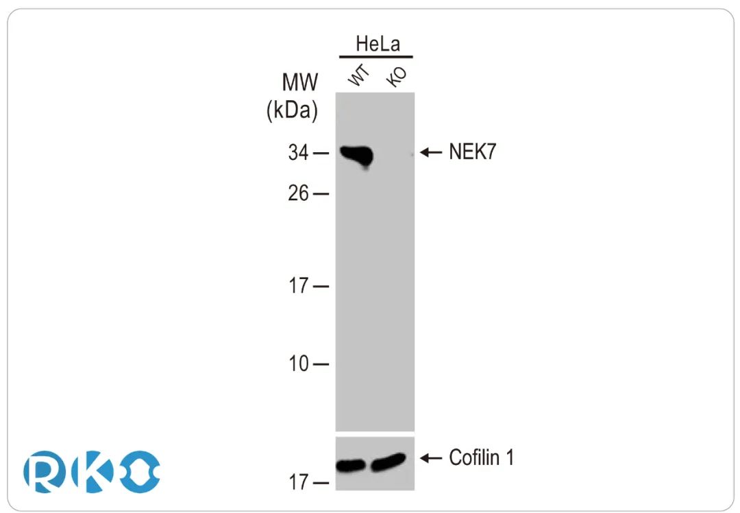 NEK7：NLRP3 炎性小体激活的重要调节剂