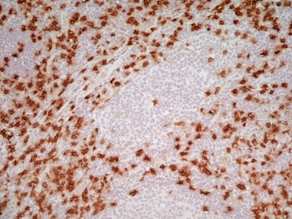 CD8 Antibody [LT8]（GTX74773），20篇文献引用